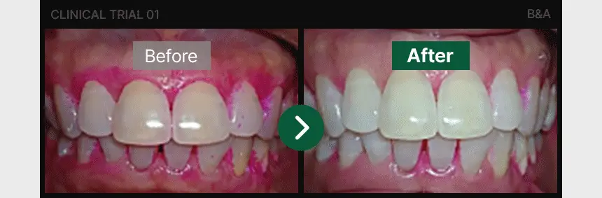 [특허성분 함유] 프로벨 메디테라 잇몸치약 (인체적용시험완료) 120g (1입/3입) 상세페이지 13